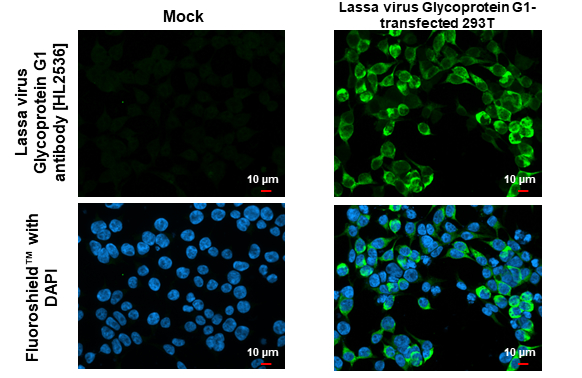 Anti-Lassa virus Glycoprotein G1 antibody [HL2536